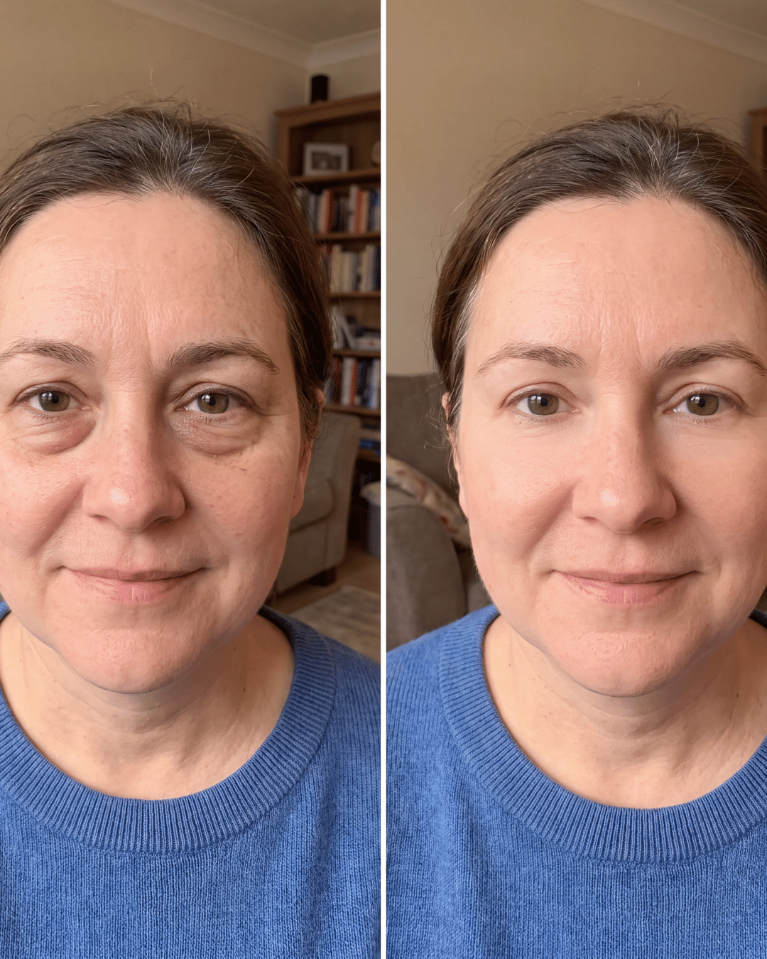 Aevum Under-Eye Recovery Patches™