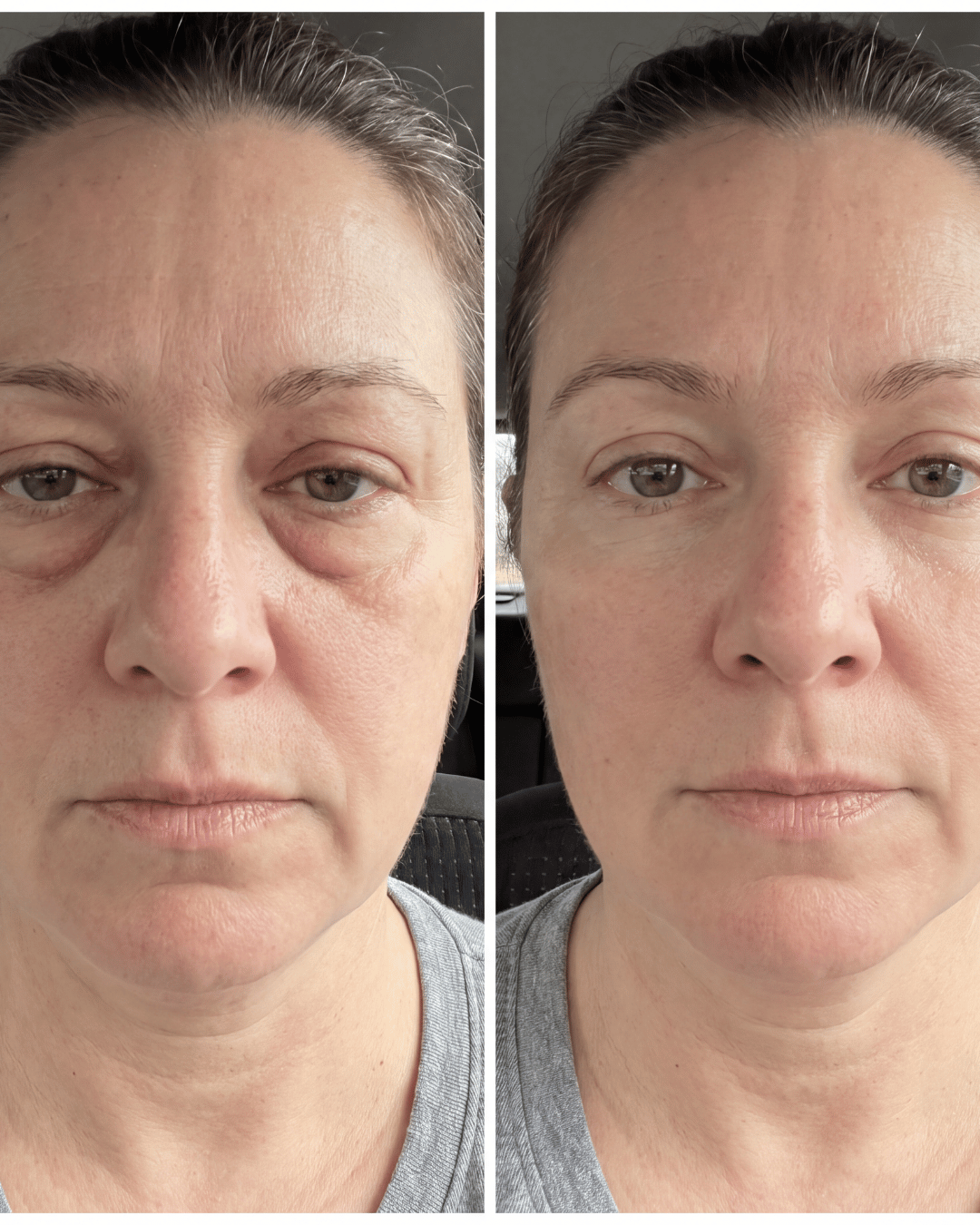 Aevum Under-Eye Recovery Patches™