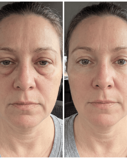Aevum Under-Eye Recovery Patches™