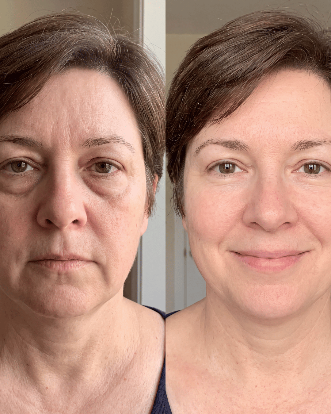 Aevum Under-Eye Recovery Patches™