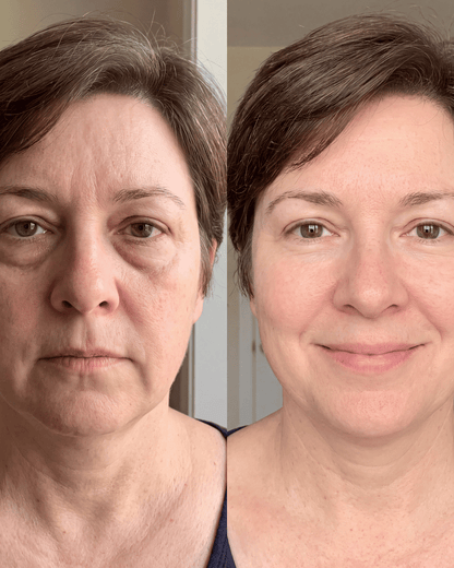 Aevum Under-Eye Recovery Patches™