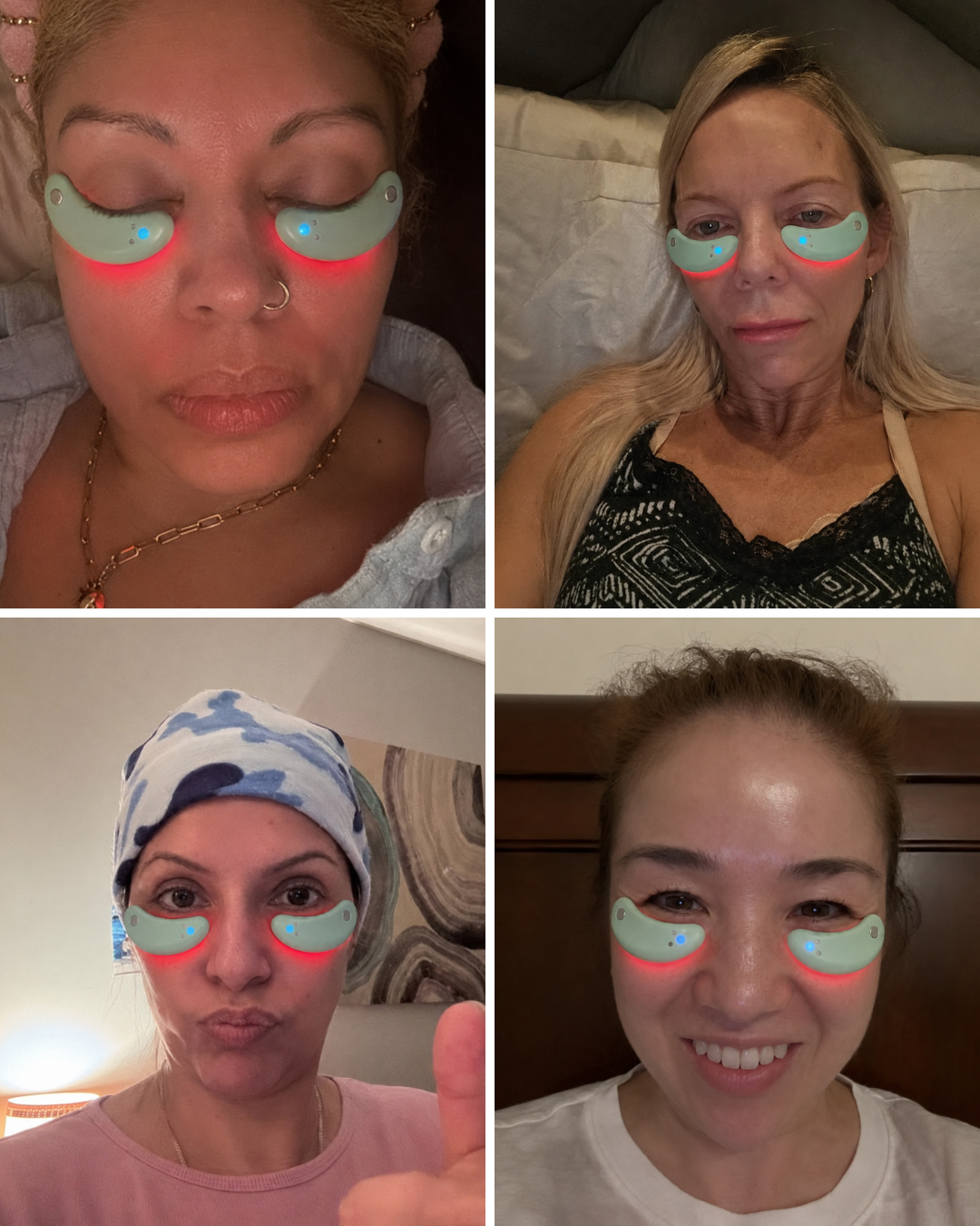 Aevum Under-Eye Recovery Patches™